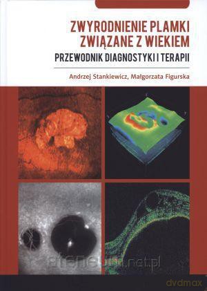 Zwyrodnienie plamki związane z wiekiem. Przewodnik [KSIĄŻKA]