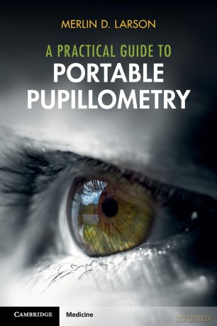 A Practical Guide to Portable Pupillometry - Merlin D. Larson [KSIĄŻKA]