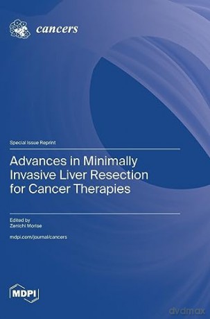 Advances in Minimally Invasive Liver Resection for Cancer Therapies - Zenichi Morise [KSIĄŻKA]