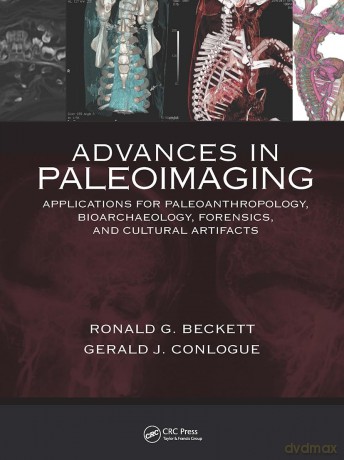 Advances in Paleoimaging: Applications for Paleoanthropology, Bioarchaeology, Forensics, and Cultural Artifacts - Gerald J. Conlogue [KSIĄŻKA]