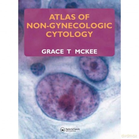 Atlas of Non-Gynecologic Cytology - Grace T. McKee [KSIĄŻKA]