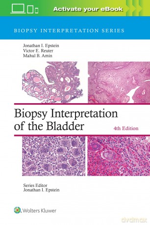 Biopsy Interpretation of the Bladder: Print + eBook with Multimedia (Biopsy Interpretation Series) - Jonathan I. Epstein [KSIĄŻKA]