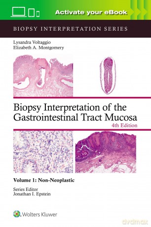 Biopsy Interpretation of the Gastrointestinal Tract Mucosa Volume 1: Non-Neoplastic: Print + eBook with Multimedia (Biopsy Interpretation Series) - Lysandra Voltaggio [KSIĄŻKA]
