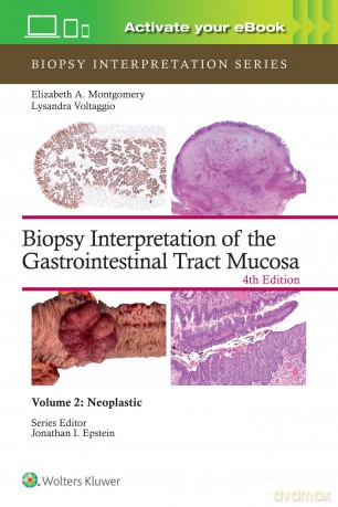 Biopsy Interpretation of the Gastrointestinal Tract Mucosa Volume 2: Neoplastic: Print + eBook with Multimedia (Biopsy Interpretation Series) - Elizabeth Anne Montgomery [KSIĄŻKA]