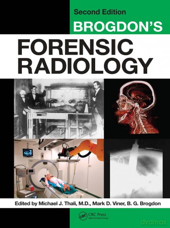 Brogdon's Forensic Radiology - B.G. Brogdon [KSIĄŻKA]