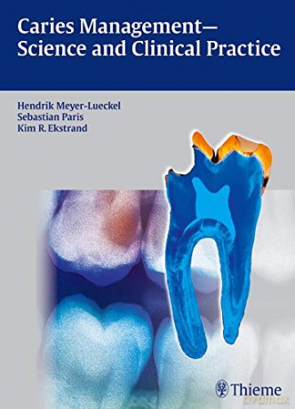 Caries Management - Science and Clinical Practice - Hendrik Meyer-Lueckel [KSIĄŻKA]