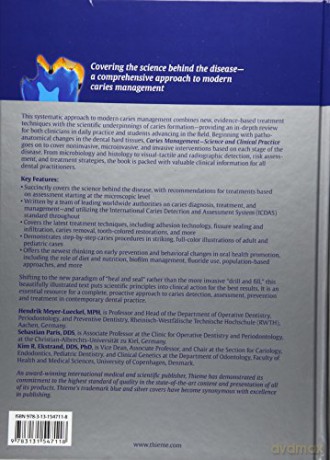 Caries Management - Science and Clinical Practice - Hendrik Meyer-Lueckel [KSIĄŻKA]