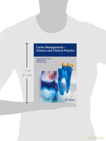 Caries Management - Science and Clinical Practice - Hendrik Meyer-Lueckel [KSIĄŻKA]
