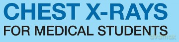 Chest X-Rays for Medical Students: CXRs Made Easy, 2nd Edition - Christopher Clarke [KSIĄŻKA]