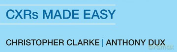 Chest X-Rays for Medical Students: CXRs Made Easy, 2nd Edition - Christopher Clarke [KSIĄŻKA]