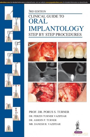 Clinical Guide to Oral Implantology: Step by Step Procedures - Porus S Turner [KSIĄŻKA]