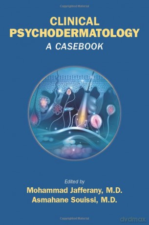 Clinical Psychodermatology: From Diagnosis to Therapy: A Casebook - Mohammad Jafferany [KSIĄŻKA]