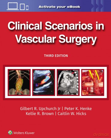 Clinical Scenarios in Vascular Surgery - Gilbert R. Upchurch Jr [KSIĄŻKA]