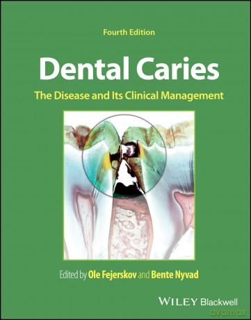 Dental Caries: The Disease and its Clinical Management - Ole Fejerskov [KSIĄŻKA]