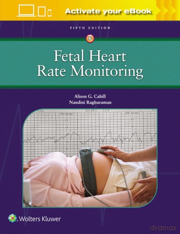 Fetal Heart Rate Monitoring - Alison Cahill [KSIĄŻKA]