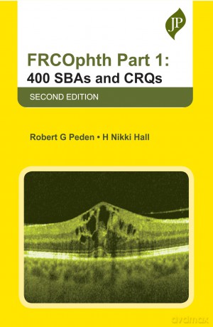 FRCOphth Part 1: 400 SBAs and CRQs - Nikki Hall [KSIĄŻKA]