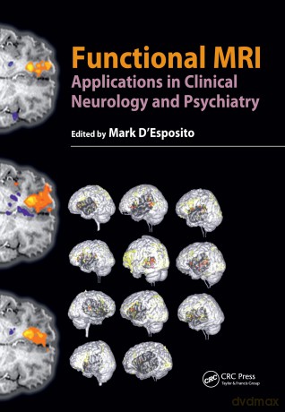 Functional MRI: Applications in Clinical Neurology and Psychiatry - Mark D'Esposito [KSIĄŻKA]