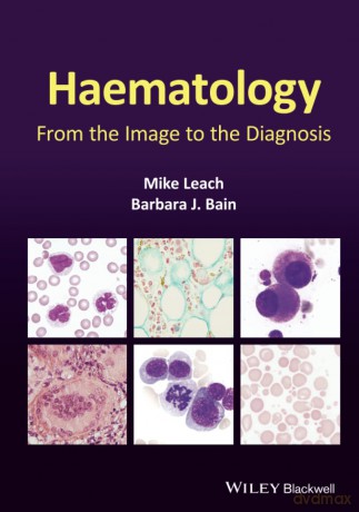 Haematology: From the Image to the Diagnosis - Mike Leach [KSIĄŻKA]