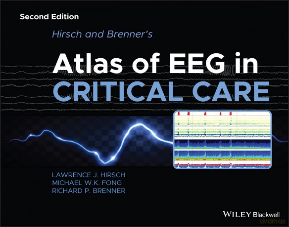 Hirsch and Brenner's Atlas of EEG in Critical Care - Lawrence J. Hirsch [KSIĄŻKA]