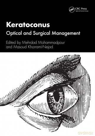 Keratoconus: Optical and Surgical Management - Mehrdad Mohammadpour [KSIĄŻKA]