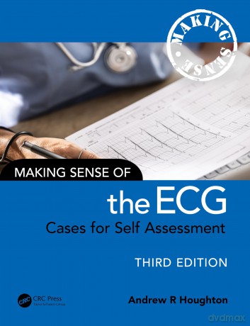 Making Sense of the ECG: Cases for Self Assessment - Andrew R. Houghton [KSIĄŻKA]