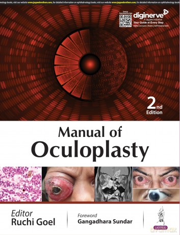 Manual of Oculoplasty - Ruchi Goel [KSIĄŻKA]