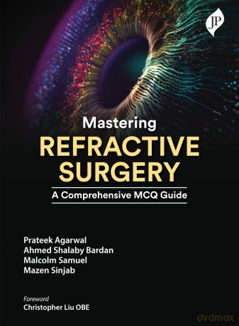 Mastering Refractive Surgery: A Comprehensive MCQ Guide - Prateek Agarwal [KSIĄŻKA]