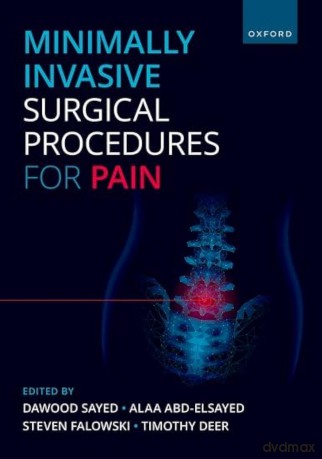 Minimally Invasive Surgical Procedures for Pain - Dawood Sayed MD [KSIĄŻKA]