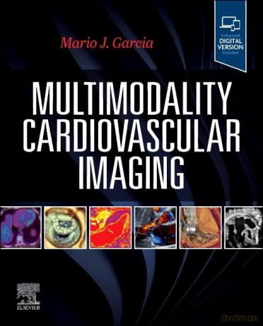 Multimodality Cardiovascular Imaging - Mario J. Garcia MD [KSIĄŻKA]