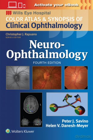 Neuro-Ophthalmology: Print + eBook with Multimedia (Wills Eye Institute Atlas Series) - Peter J. Savino [KSIĄŻKA]