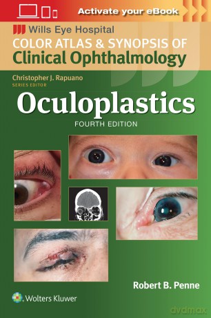 Oculoplastics: Wills Eye Institute Atlas Series - Robert Penne [KSIĄŻKA]