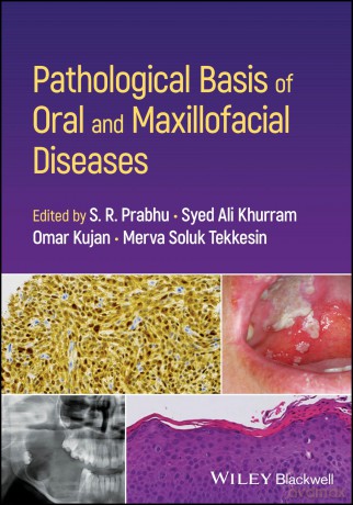 Pathological Basis of Oral and Maxillofacial Diseases - S. R. Prabhu [KSIĄŻKA]