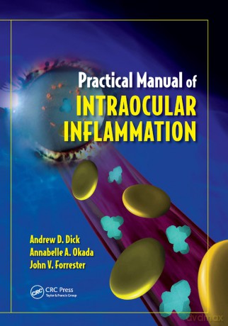 Practical Manual of Intraocular Inflammation - Andrew Dick [KSIĄŻKA]