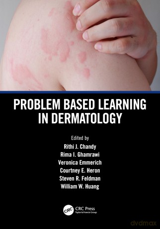 Problem Based Learning in Dermatology - Rithi John Chandy [KSIĄŻKA]