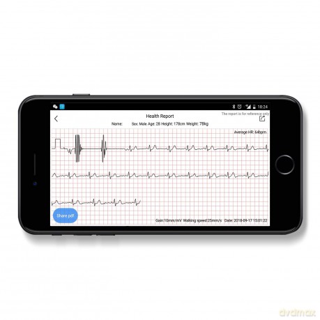 Opaska Fitness Tracker EKG PR-650
