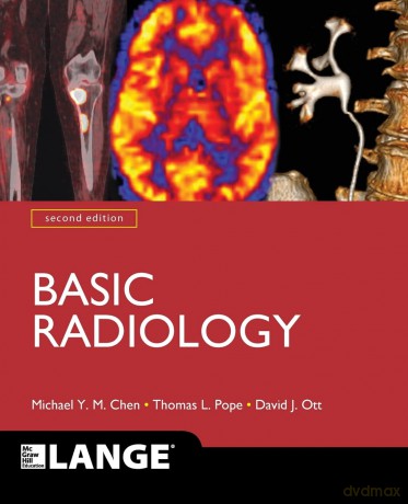 Basic Radiology, Second Edition [KSIĄŻKA]