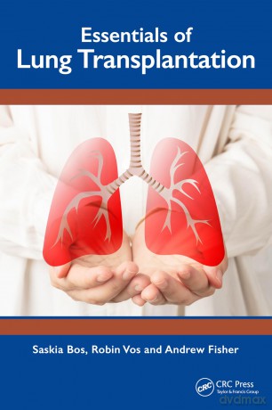 Essentials of Lung Transplantation [KSIĄŻKA]