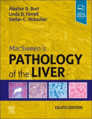 MacSween's Pathology of the Liver [KSIĄŻKA]