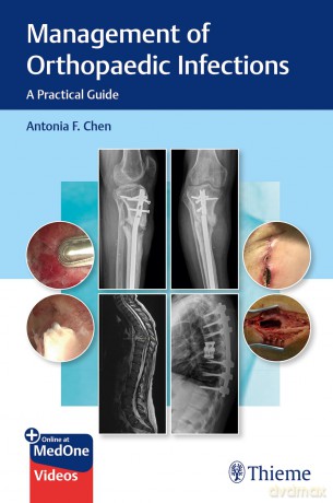 Management of Orthopaedic Infections: A Practical Guide [KSIĄŻKA]