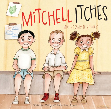 Mitchell Itches: An eczema story [KSIĄŻKA]