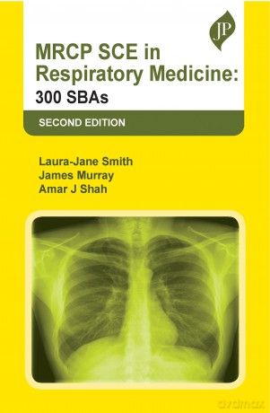 MRCP SCE in Respiratory Medicine: 300 SBAs [KSIĄŻKA]