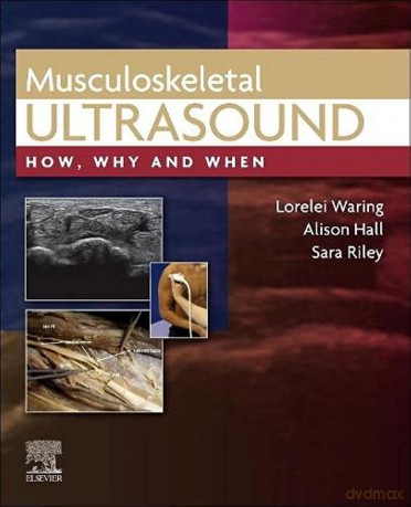Musculoskeletal Ultrasound: How, Why and When [KSIĄŻKA]