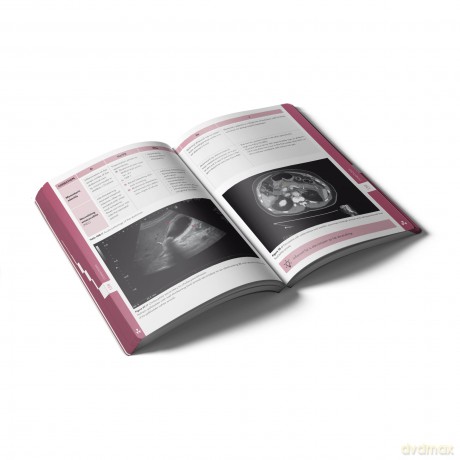 Pocket Radiology [KSIĄŻKA]