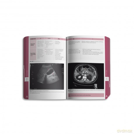 Pocket Radiology [KSIĄŻKA]