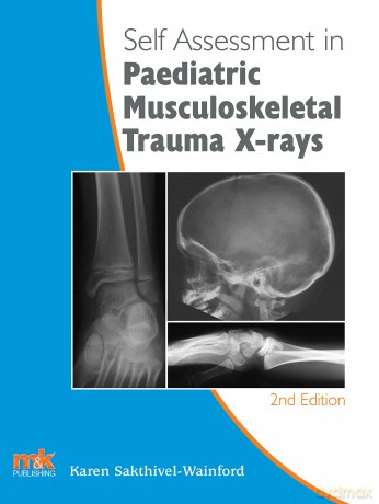 Self-Assessment in Paediatric Musculoskeletal Trauma X-Rays [KSIĄŻKA]