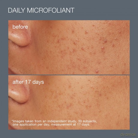 Best Cleanse + Glow Skincare Gift Set