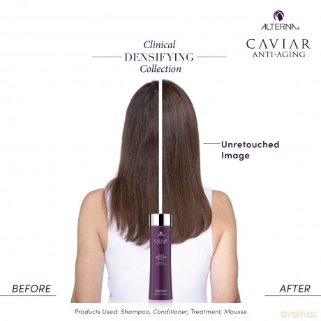 Caviar Clinical Densifying Shampoo for Thin and Weakened Hair Thickens Thinning Hair Shampoo - Volume: 40 ml