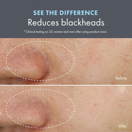 Cleansing mask for problematic skin Clear Improvement Blackhead Clearing Mask-To-Scrub 75 ml