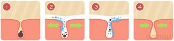 Detoxifying face mask Deep Detox Tightening Mask - Variant: 1 piece