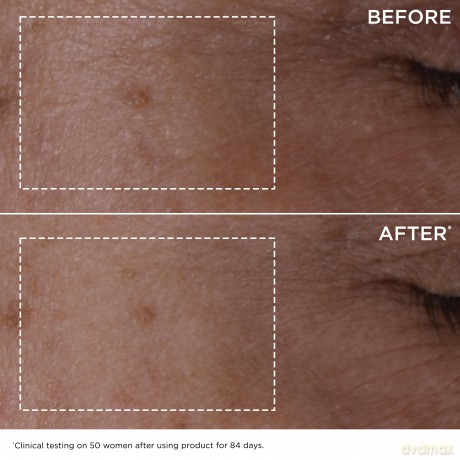 Double Serum Complete Age Defying Concentrate - Volume: 50 ml